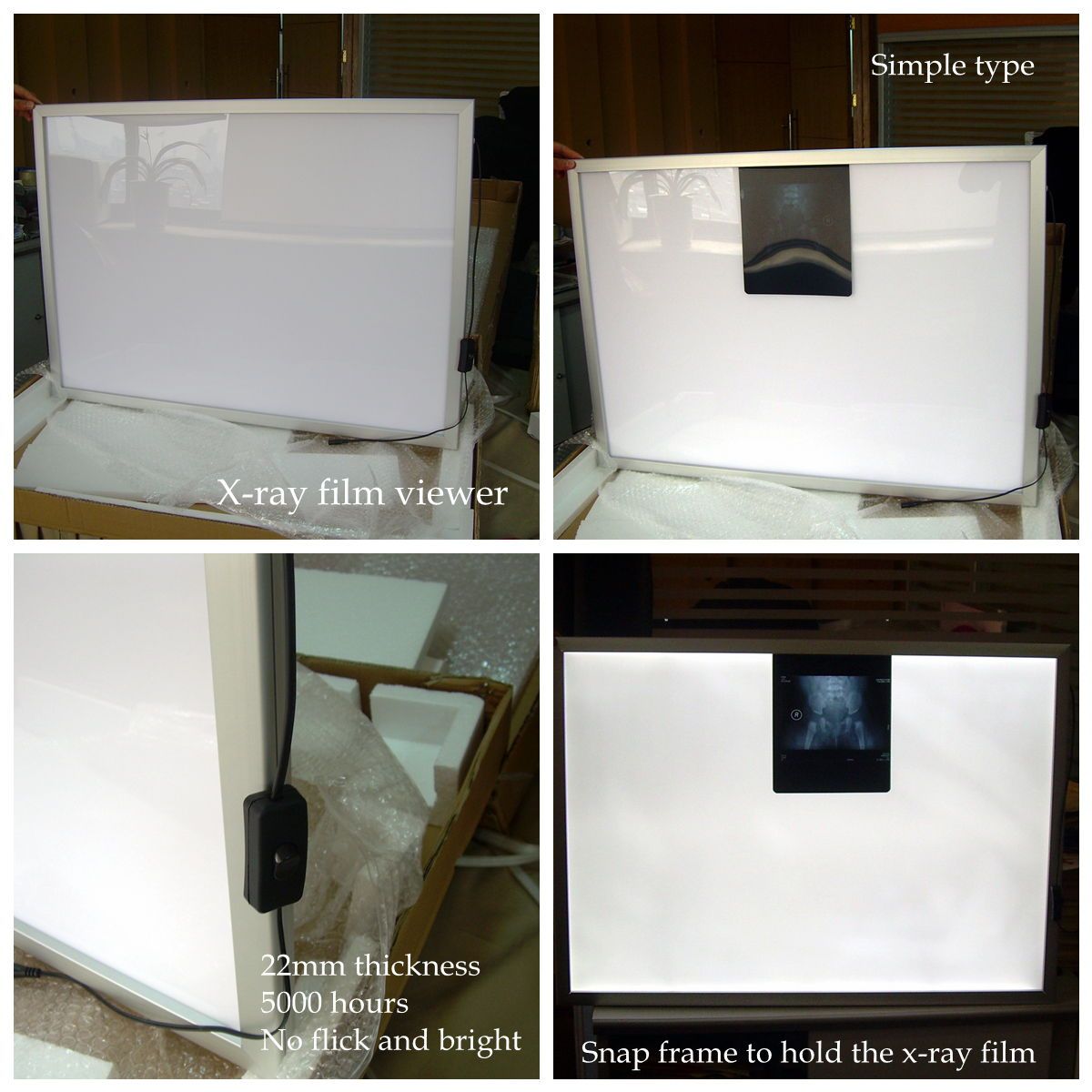 LED Medical X-ray Film View Light Box, 14*17 Inch